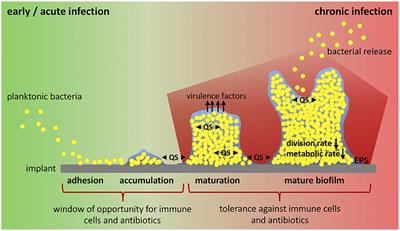 Chronic Implant-Related Bone Infections—Can Immune Modulation be a Therapeutic Strategy?